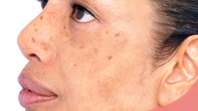 475832007_999903605499461_6470792403834764495_n