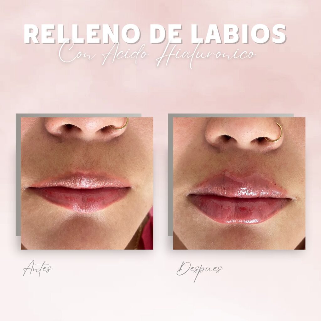 475993513_624273163524379_1435360560837306048_n