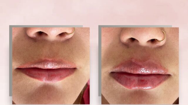 475993513_624273163524379_1435360560837306048_n