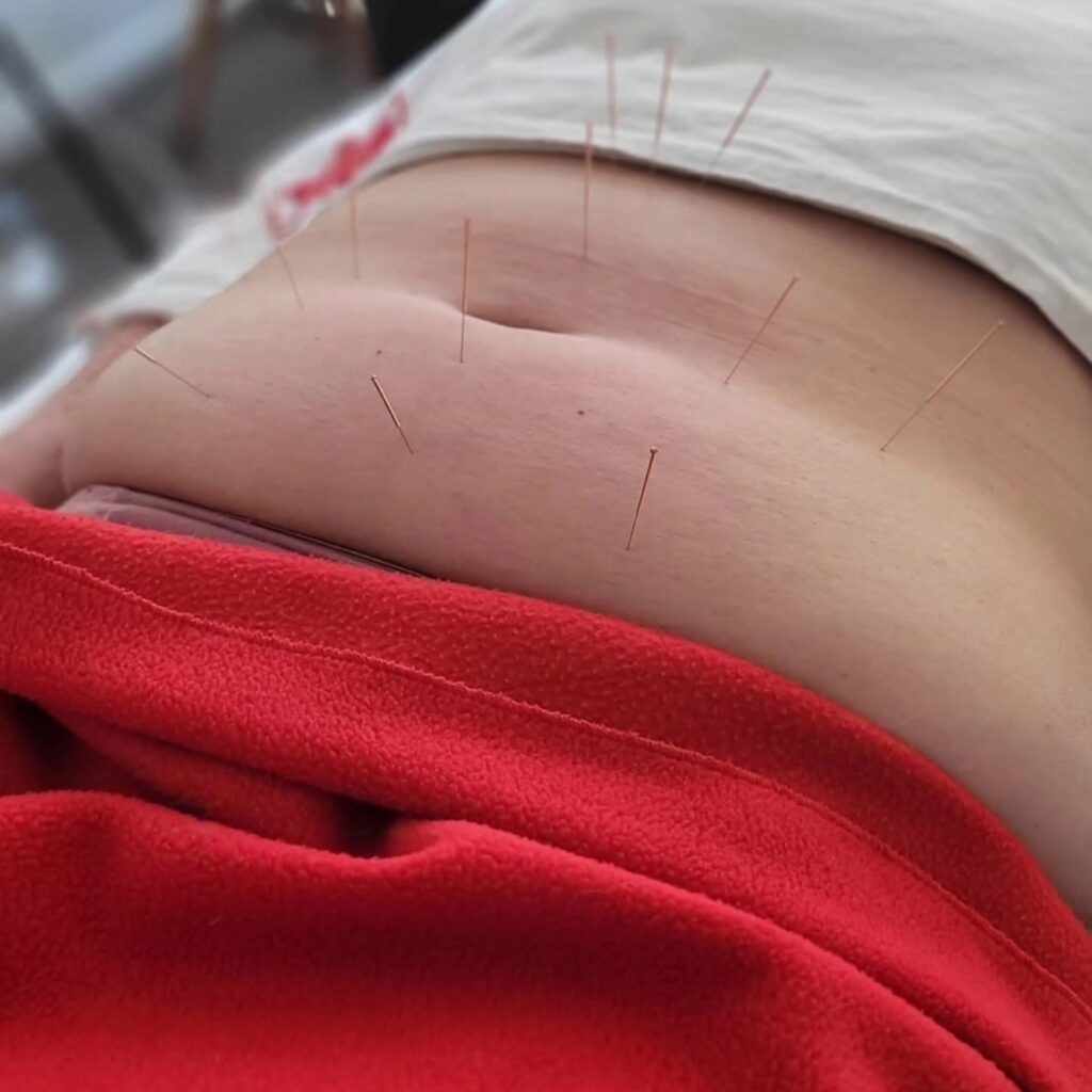 475046500_122185261946249430_4119659185059727047_n