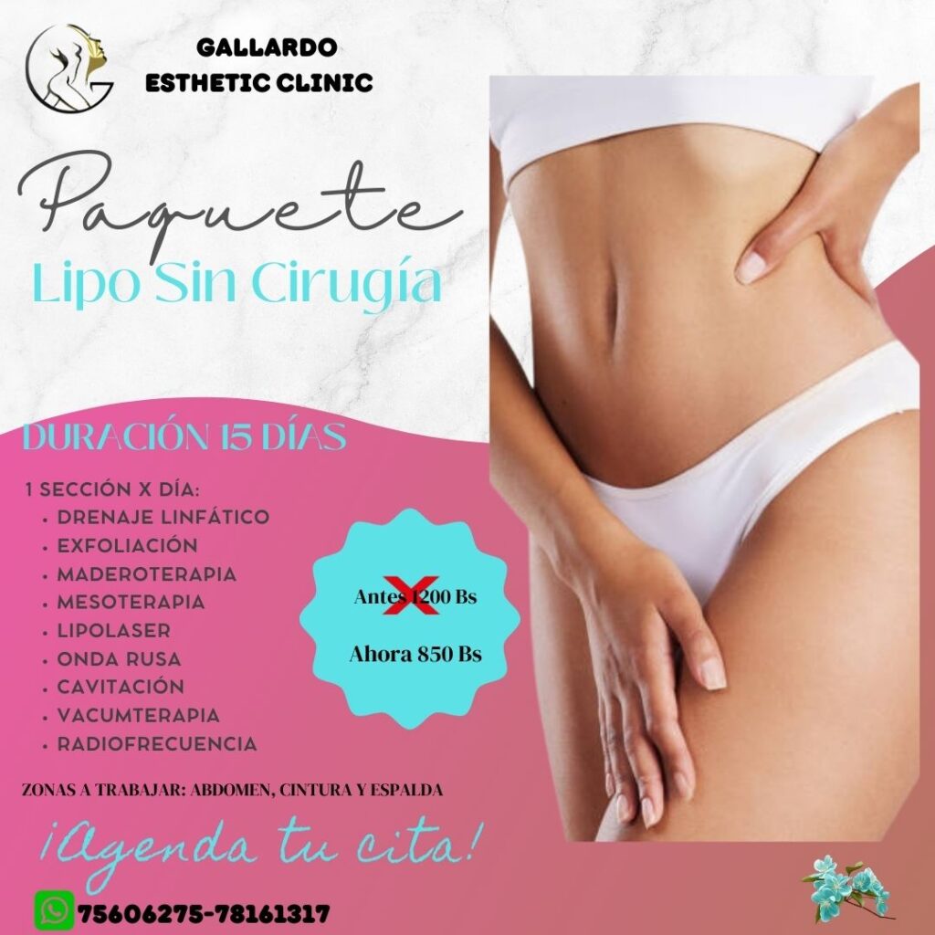 475700917_122199242396130402_6764493958072207485_n