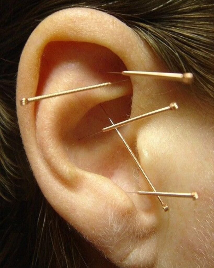 477716320_122188112096249430_440703277035087223_n