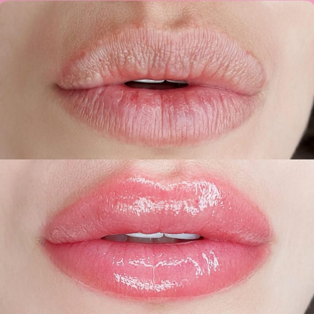 480782636_17978276612811823_1176697652504698782_n