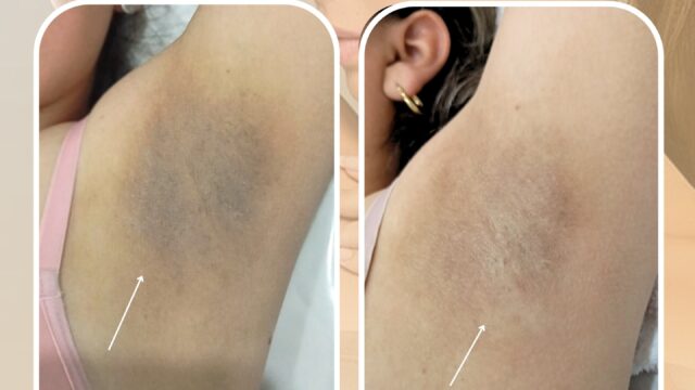 482601431_18347318311199824_4948090215763054992_n