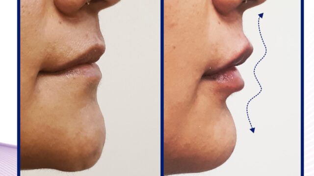 474488011_1019265926687471_7037320270927483674_n