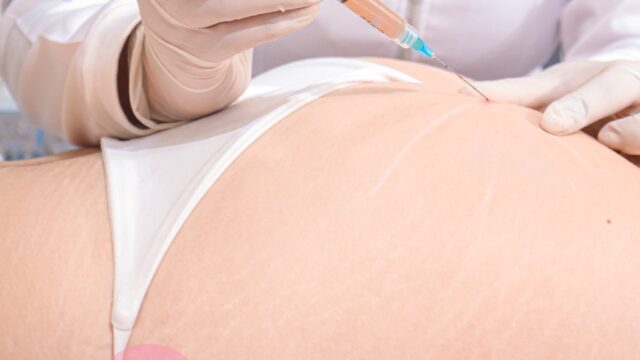 550657522_725854693817013_5207333335401691577_n