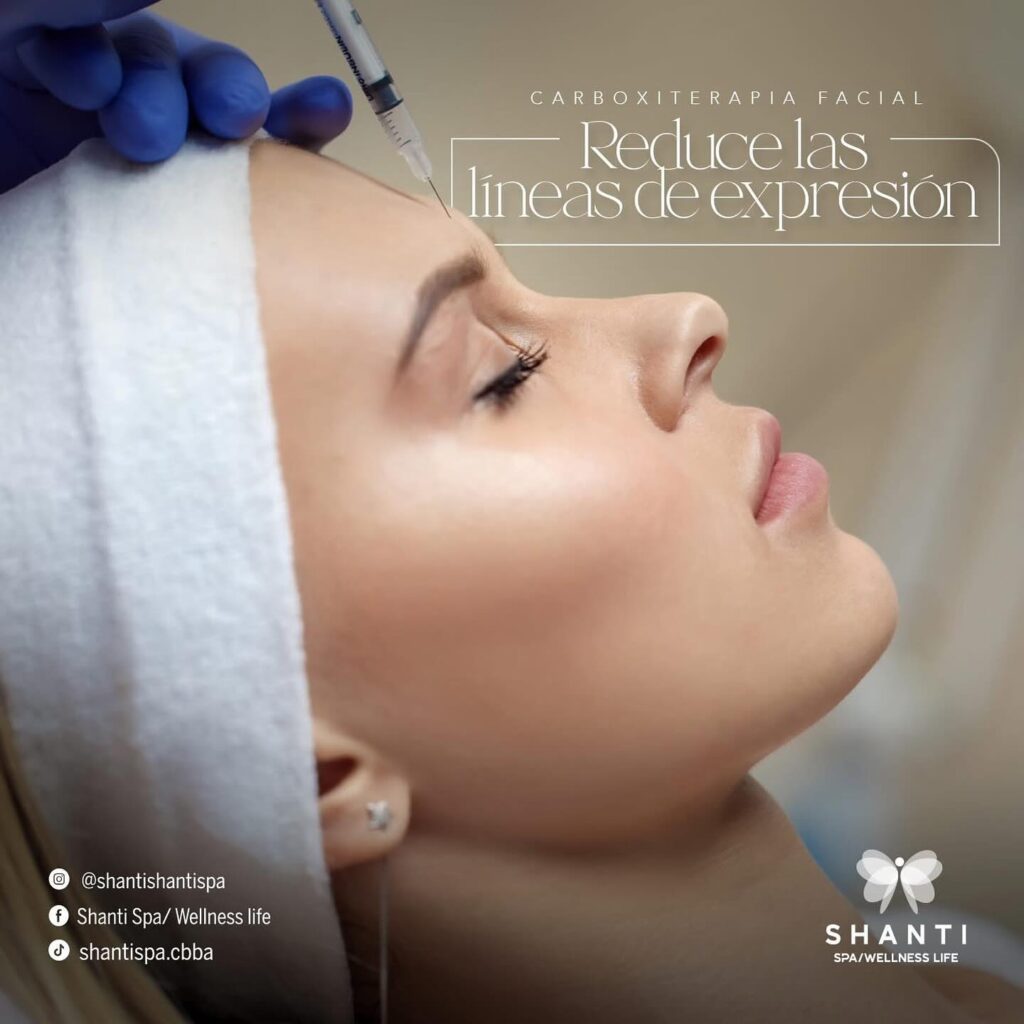 564164204_18061236470570370_7890709206149395744_n