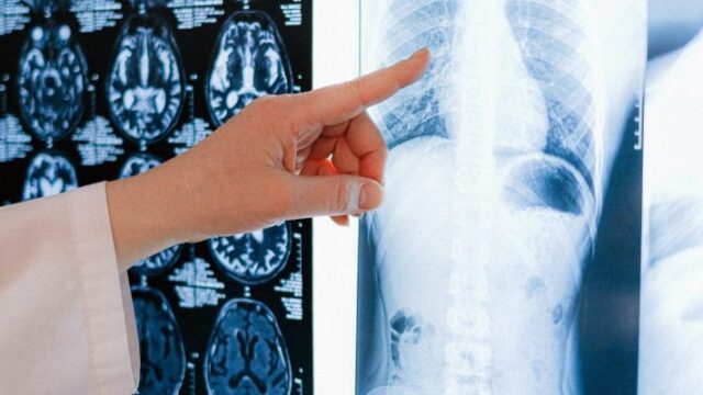 tcm_departamento-rayosx-scaled-pjl5ug4i1oyt56dthukeib1pq4mx16opqa6c7yhvvk