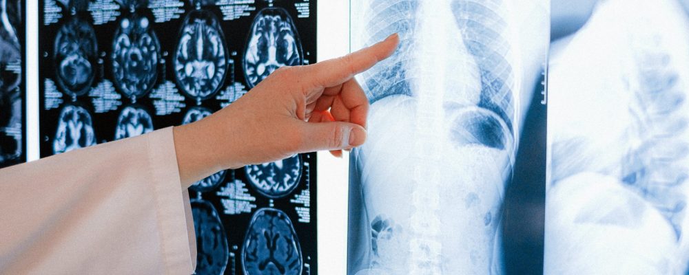 tcm_departamento-rayosx-scaled-pjl5ug4i1oyt56dthukeib1pq4mx16opqa6c7yhvvk