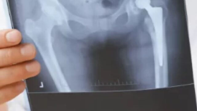 481468635_964352199134134_1178676711198376474_n