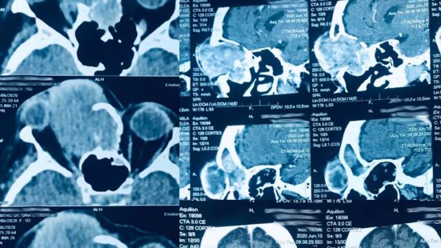 117105854_3067350086667603_7854453142968390437_n