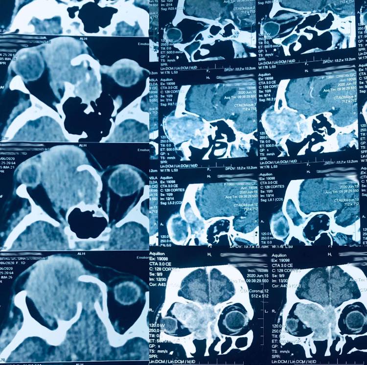 117105854_3067350086667603_7854453142968390437_n