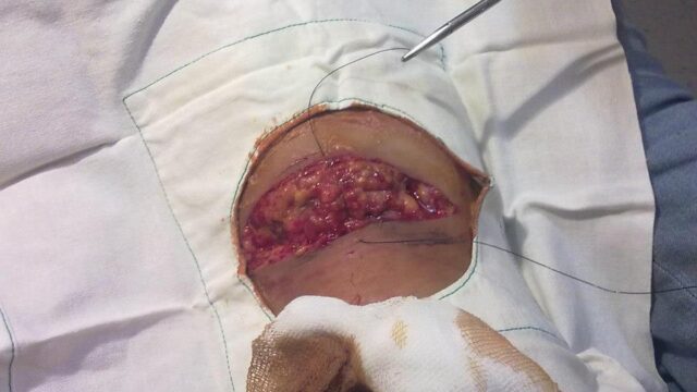 502709882_3555146027949743_2345844556610480966_n