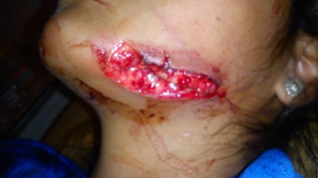 502908225_3555145737949772_8624320905783891193_n