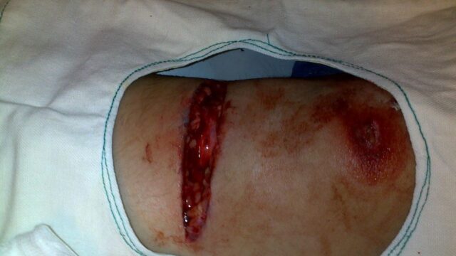 503254967_3555145704616442_4224476855710939794_n