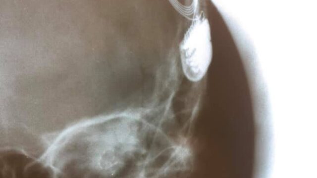 67474318_2273928452676441_7911660424469151744_n