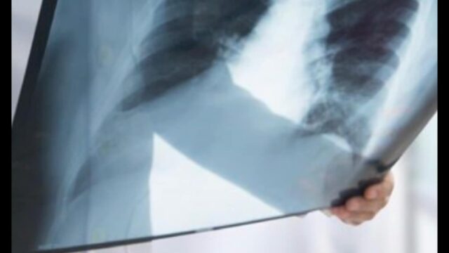 477792734_1825868634833326_6249782722248571366_n