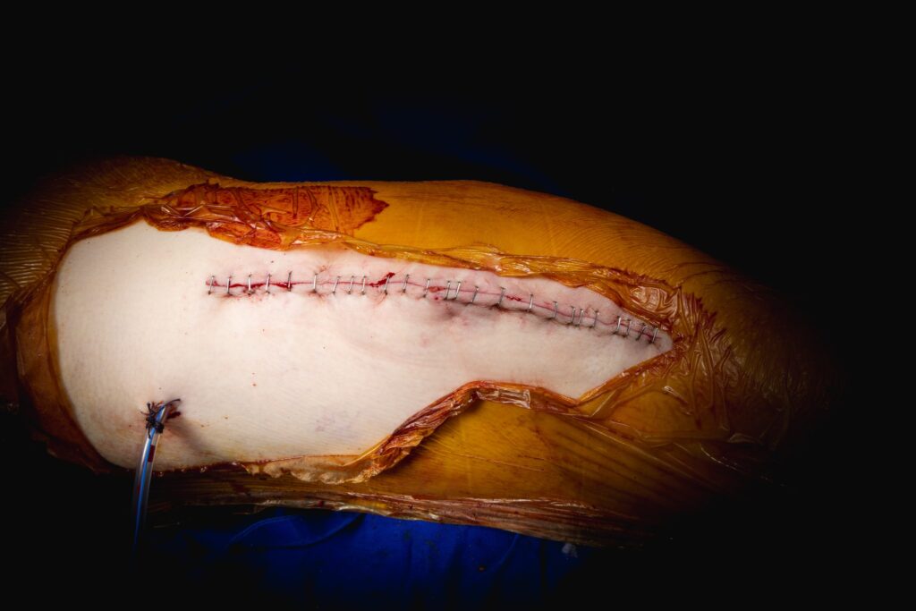 672343054_1587108043423606_7648753553512303247_n