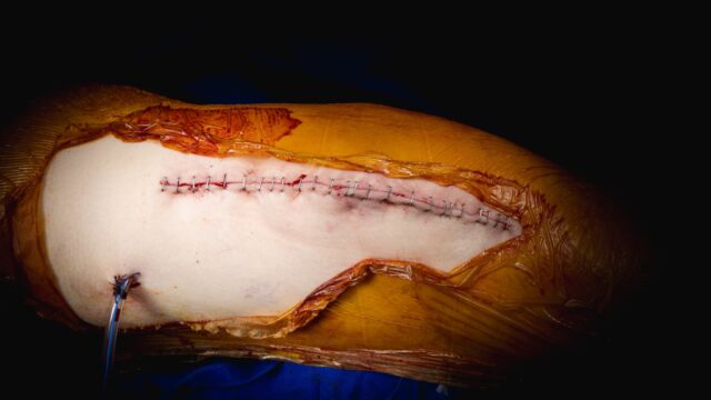 672343054_1587108043423606_7648753553512303247_n